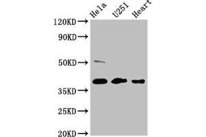Western Blot Positive WB detected in: Hela whole cell lysate, U251 whole cell lysate, Mouse heart tissue All lanes: RCN3 antibody at 4. (RCN3 anticorps  (AA 71-161))