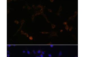 Immunofluorescence analysis of NIH/3T3 cells using UBE2L6 Polyclonal Antibody at dilution of 1:100.