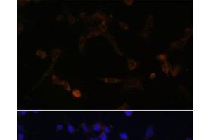 Immunofluorescence analysis of NIH/3T3 cells using UBE2L6 Polyclonal Antibody at dilution of 1:100. (UBE2L6 anticorps)