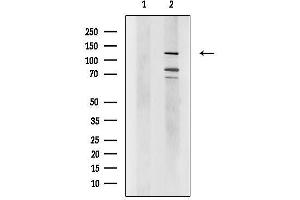 anti-Zinc Finger Protein, FOG Family Member 2 (ZFPM2) (C-Term) antibody