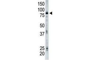 Image no. 1 for anti-SMAD Specific E3 Ubiquitin Protein Ligase 2 (SMURF2) (N-Term) antibody (ABIN357471)
