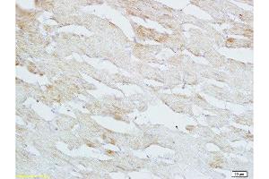 Formalin-fixed and paraffin embedded rat heart tissue labeled with Anti-HB EGF Polyclonal Antibody, Unconjugated  at 1:200 followed by conjugation to the secondary antibody and DAB staining