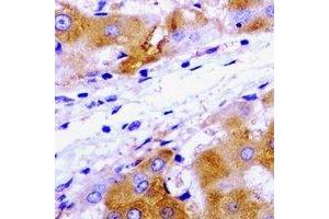 Immunohistochemical analysis of UBE2J2 staining in rat liver  formalin fixed paraffin embedded tissue section.