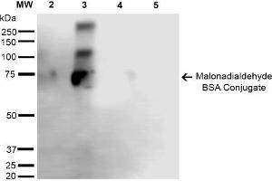 Western Blot analysis of Malondialdehyde-BSA Conjugate showing detection of 67 kDa Malondialdehyde -BSA using Mouse Anti-Malondialdehyde Monoclonal Antibody, Clone 6H6 . (Malondialdehyde anticorps)