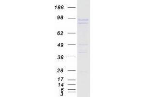 Validation with Western Blot