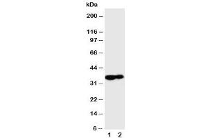 Western blot testing of Kallikrein 9 antibody and Lane 1:  MCF-7 (Kallikrein 9 anticorps  (C-Term))