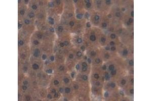 IHC-P analysis of Kidney tissue, with DAB staining.
