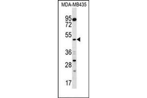 Western blot analysis of SNX4 Antibody (C-term) in MDA-MB435 cell line lysates (35ug/lane).