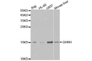 Western blot analysis of extracts of various cell lines, using GHRH antibody. (GHRH anticorps  (AA 21-107))