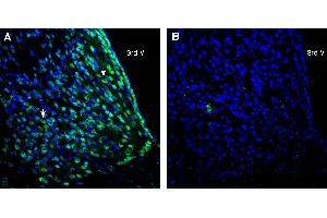 Expression of CD81 in rat medial habenula. (CD81 anticorps  (Extracellular))