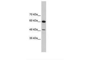 Image no. 3 for anti-DAZ Associated Protein 1 (DAZAP1) (AA 321-370) antibody (ABIN202449) (DAZAP1 anticorps  (AA 321-370))