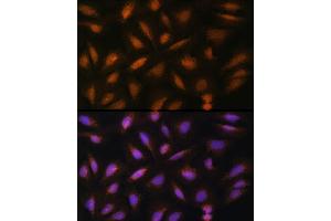 Immunofluorescence analysis of U-2 OS cells using FGF2 Rabbit pAb (ABIN3020744, ABIN3020745, ABIN3020746 and ABIN6213702) at dilution of 1:100 (40x lens). (FGF2 anticorps  (AA 143-288))