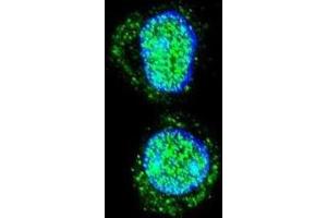 Immunofluorescence (IF) image for anti-Homeobox A10 (HOXA10) antibody (ABIN2995594) (HOXA10 anticorps)