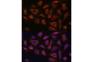 Immunofluorescence analysis of U-2 OS cells using  antibody (ABIN7265486) at dilution of 1:100. (arfgap2 anticorps  (AA 242-521))