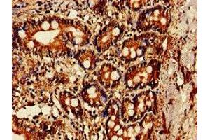 Immunohistochemistry of paraffin-embedded human small intestine tissue using ABIN7142170 at dilution of 1:100 (OAS1 anticorps  (AA 296-395))