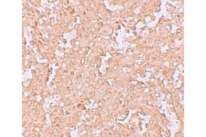 Immunohistochemical staining of human spleen cells with ZBTB8 polyclonal antibody  at 2. (ZBTB8A anticorps  (C-Term))