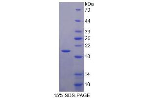 SDS-PAGE analysis of Human EP1 Protein.