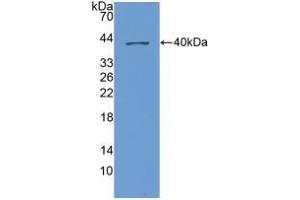 Western blot analysis of recombinant Human NAP3. (CXCL1 anticorps  (AA 35-107))