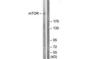 Western blot analysis of extracts from NIH-3T3 cells, treated with Insulin 0. (MTOR anticorps  (AA 2412-2461))