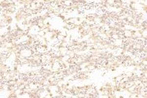 Immunohistochemistry analysis of paraffin-embedded rat placenta using,Slc6a6 (ABIN7075842) at dilution of 1: 1000 (TAUT anticorps)