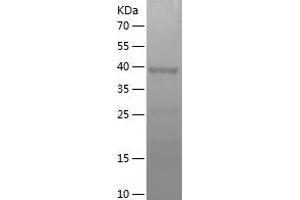 Western Blotting (WB) image for Methionine Adenosyltransferase I, alpha (MAT1A) (AA 215-395) protein (His-IF2DI Tag) (ABIN7123931)