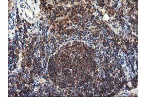 Image no. 5 for anti-Leucine Carboxyl Methyltransferase 1 (LCMT1) antibody (ABIN1499109)