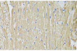 Immunohistochemistry of paraffin-embedded Rat heart using FHIT Polyclonal Antibody at dilution of 1:100 (40x lens). (FHIT anticorps)