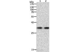 Western blot analysis of k562 cell and Hela cell, using HAVCR1 Polyclonal Antibody at dilution of 1:700 (HAVCR1 anticorps)