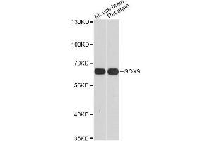 Western blot analysis of extracts of various cell lines, using SOX9 antibody. (SOX9 anticorps  (AA 100-200))