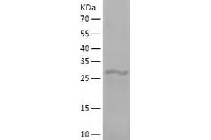 Western Blotting (WB) image for Ribosomal Protein L8 (RPL8) (AA 1-257) protein (His-IF2DI Tag) (ABIN7124889)