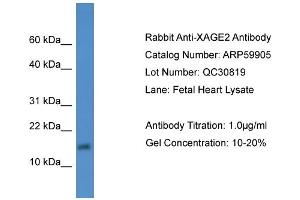 WB Suggested Anti-XAGE2  Antibody Titration: 0. (XAGE2 anticorps  (Middle Region))
