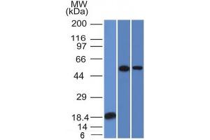 Western Blot Analysis (A) Recombinant protein (B) A549 (C) A431 TOX3 Mouse Monoclonal Antibody (TOX3/1124). (TOX3 anticorps  (AA 251-389))