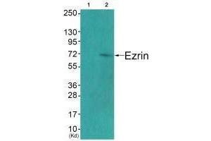 Western blot analysis of extracts from COS7 cells (Lane 2), using Ezrin (Ab-478) antiobdy. (Ezrin anticorps  (Tyr478))