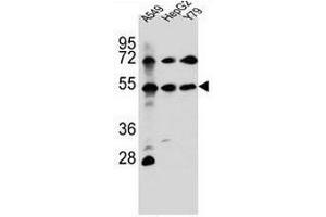 FGFRL1 Antibody (N-term) western blot analysis in A549,HepG2,Y79 cell line lysates (35µg/lane). (FGFRL1 anticorps  (N-Term))