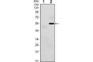 Western blot analysis using EIF2AK3 mAb against HEK293 (1) and EIF2AK3(AA: 929-1116)-hIgGFc transfected HEK293 (2) cell lysate. (PERK anticorps)