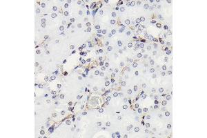 Immunohistochemistry of paraffin-embedded mouse kidney using Phospho-Histone H3-S10 antibody (ABIN3019419, ABIN3019420, ABIN3019421, ABIN1681355 and ABIN7101861) at dilution of 1:100 (40x lens).