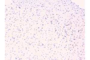 IHC analysis of TNFRSF11B using anti-TNFRSF11B antibody (ABIN7600875).