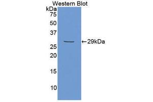 Western Blotting (WB) image for anti-Matrix Extracellular phosphoglycoprotein (MEPE) (AA 212-445) antibody (ABIN1859804) (MEPE anticorps  (AA 212-445))