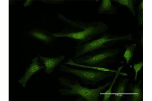 Immunofluorescence of purified MaxPab antibody to IFI35 on HeLa cell. (IFI35 anticorps  (AA 1-288))