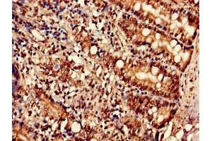 Immunohistochemistry of paraffin-embedded human small intestine tissue using ABIN7170231 at dilution of 1:100 (SLC35F2 anticorps  (AA 335-374))