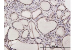 Immunoperoxidase of purified MaxPab antibody to ILF2 on formalin-fixed paraffin-embedded human thyroid nodular goiter. (ILF2 anticorps  (AA 1-390))