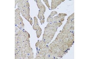 Immunohistochemistry of paraffin-embedded mouse heart using HBA2 antibody at dilution of 1:100 (x40 lens). (HBa2 anticorps)