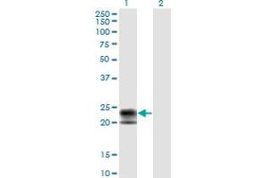 Western Blot analysis of TNFRSF17 expression in transfected 293T cell line by TNFRSF17 monoclonal antibody (M01), clone 1F10. (BCMA anticorps  (AA 1-184))