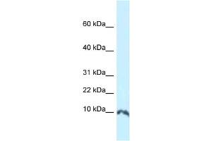 WB Suggested Anti-Sumo1 Antibody   Titration: 1. (SUMO1 anticorps  (N-Term))