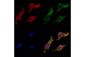 ABIN6262775 and ABIN6269025 staining HepG2 by IF/ICC. (KRT16 anticorps  (C-Term))