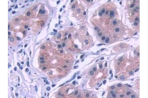 DAB staining on IHC-P; Samples: Human Stomach Tissue (KEAP1 anticorps  (AA 327-624))