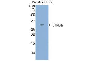Detection of Recombinant STAT4, Human using Polyclonal Antibody to Signal Transducer And Activator Of Transcription 4 (STAT4)
