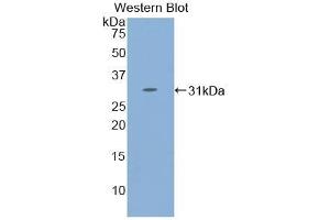 Detection of Recombinant STAT4, Human using Polyclonal Antibody to Signal Transducer And Activator Of Transcription 4 (STAT4) (STAT4 anticorps  (AA 505-737))