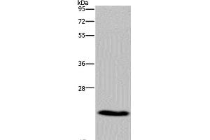Western Blot analysis of Mouse heart tissue using CMTM5 Polyclonal Antibody at dilution of 1:400 (CMTM5 anticorps)