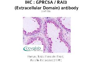 Image no. 2 for anti-G Protein-Coupled Receptor, Family C, Group 5, Member A (GPRC5A) (2nd Extracellular Domain) antibody (ABIN1735207) (GPRC5A anticorps  (2nd Extracellular Domain))